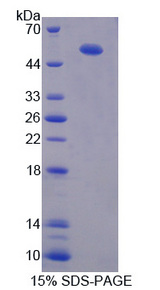 CHRDL1 Protein - Recombinant Chordin Like Protein 1 By SDS-PAGE