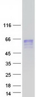 CHRDL2 Protein - Purified recombinant protein CHRDL2 was analyzed by SDS-PAGE gel and Coomassie Blue Staining