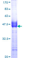 CHRM2 / M2 Protein - 12.5% SDS-PAGE Stained with Coomassie Blue.