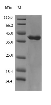 CHRM3 / M3 Protein - (Tris-Glycine gel) Discontinuous SDS-PAGE (reduced) with 5% enrichment gel and 15% separation gel.