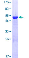 CHRM3 / M3 Protein - 12.5% SDS-PAGE Stained with Coomassie Blue.