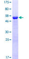 CHRM3 / M3 Protein - 12.5% SDS-PAGE Stained with Coomassie Blue.