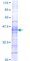 CHRM5 / M5 Protein - 12.5% SDS-PAGE Stained with Coomassie Blue.