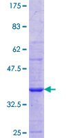 CHRNA1 Protein - 12.5% SDS-PAGE Stained with Coomassie Blue.
