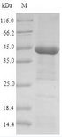 CHRNA1 Protein - (Tris-Glycine gel) Discontinuous SDS-PAGE (reduced) with 5% enrichment gel and 15% separation gel.