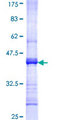 CHRNA2 Protein - 12.5% SDS-PAGE Stained with Coomassie Blue.