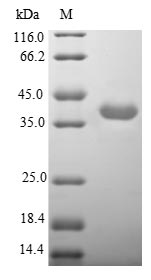 CHRNA3 Protein - (Tris-Glycine gel) Discontinuous SDS-PAGE (reduced) with 5% enrichment gel and 15% separation gel.