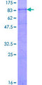 CHRNA3 Protein - 12.5% SDS-PAGE of human CHRNA3 stained with Coomassie Blue