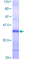 CHRNA3 Protein - 12.5% SDS-PAGE Stained with Coomassie Blue.