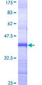 CHRNA3 Protein - 12.5% SDS-PAGE Stained with Coomassie Blue.