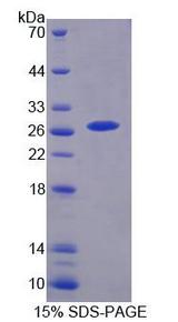 CHRNA3 Protein - Recombinant Cholinergic Receptor, Nicotinic, Alpha 3 By SDS-PAGE