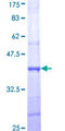 CHRNA4 / NACHR Protein - 12.5% SDS-PAGE Stained with Coomassie Blue.