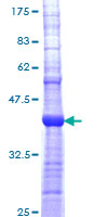 CHRNA5 Protein - 12.5% SDS-PAGE Stained with Coomassie Blue.