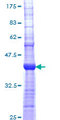 CHRNA5 Protein - 12.5% SDS-PAGE Stained with Coomassie Blue.