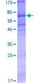 CHRNA9 Protein - 12.5% SDS-PAGE of human CHRNA9 stained with Coomassie Blue