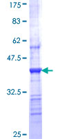CHRNB1 Protein - 12.5% SDS-PAGE Stained with Coomassie Blue.