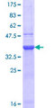 CHRNB2 Protein - 12.5% SDS-PAGE Stained with Coomassie Blue.