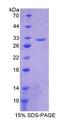 CHRNB2 Protein - Recombinant Cholinergic Receptor, Nicotinic, Beta 2 By SDS-PAGE
