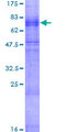 CHRNB3 Protein - 12.5% SDS-PAGE of human CHRNB3 stained with Coomassie Blue