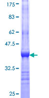 CHRNB3 Protein - 12.5% SDS-PAGE Stained with Coomassie Blue.