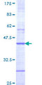 CHRNB4 Protein - 12.5% SDS-PAGE Stained with Coomassie Blue.