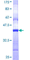 CHRND Protein - 12.5% SDS-PAGE Stained with Coomassie Blue.