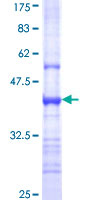 CHRNE Protein - 12.5% SDS-PAGE Stained with Coomassie Blue.