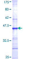 CHST1 Protein - 12.5% SDS-PAGE Stained with Coomassie Blue.