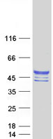 CHST10 Protein - Purified recombinant protein CHST10 was analyzed by SDS-PAGE gel and Coomassie Blue Staining