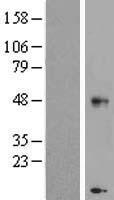 CHST11 Protein - Western validation with an anti-DDK antibody * L: Control HEK293 lysate R: Over-expression lysate