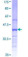 CHST11 Protein - 12.5% SDS-PAGE Stained with Coomassie Blue.