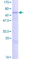 CHST12 Protein - 12.5% SDS-PAGE of human CHST12 stained with Coomassie Blue
