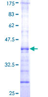 CHST12 Protein - 12.5% SDS-PAGE Stained with Coomassie Blue.