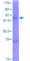 CHST13 Protein - 12.5% SDS-PAGE of human CHST13 stained with Coomassie Blue