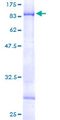 CHST15 Protein - 12.5% SDS-PAGE of human GALNAC4S-6ST stained with Coomassie Blue