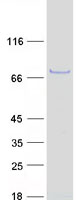 CHST15 Protein - Purified recombinant protein CHST15 was analyzed by SDS-PAGE gel and Coomassie Blue Staining