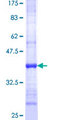 CHST2 Protein - 12.5% SDS-PAGE Stained with Coomassie Blue.