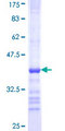 CHST3 Protein - 12.5% SDS-PAGE Stained with Coomassie Blue.