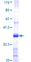 CHST4 / GlcNAc6ST2 Protein - 12.5% SDS-PAGE Stained with Coomassie Blue.