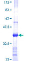 CHST4 / GlcNAc6ST2 Protein - 12.5% SDS-PAGE Stained with Coomassie Blue.