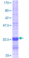 CHST5 Protein - 12.5% SDS-PAGE Stained with Coomassie Blue.