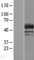 CHST6 Protein - Western validation with an anti-DDK antibody * L: Control HEK293 lysate R: Over-expression lysate