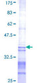 CHST6 Protein - 12.5% SDS-PAGE Stained with Coomassie Blue.