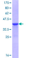 CHSY1 Protein - 12.5% SDS-PAGE Stained with Coomassie Blue.