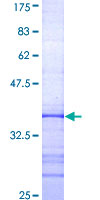 CHTF18 / RUVBL Protein - 12.5% SDS-PAGE Stained with Coomassie Blue.