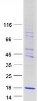 CHTF8 / C10orf18 Protein - Purified recombinant protein CHTF8 was analyzed by SDS-PAGE gel and Coomassie Blue Staining