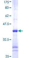 CHUK / IKKA / IKK Alpha Protein - 12.5% SDS-PAGE Stained with Coomassie Blue.