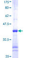 CHUK / IKKA / IKK Alpha Protein - 12.5% SDS-PAGE Stained with Coomassie Blue.