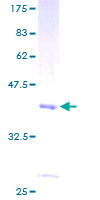 CHURC1 Protein - 12.5% SDS-PAGE of human CHURC1 stained with Coomassie Blue