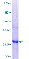 Chymotrypsin C Protein - 12.5% SDS-PAGE Stained with Coomassie Blue.